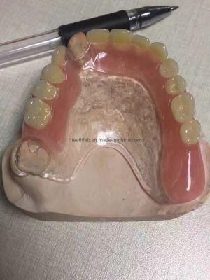 Thermosens Partial Denture