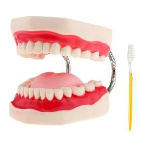 Demonstration Model of Tooth Decay and Caries Development Decayed Teeth Anatomical Model Teaching Resources Dentist Used