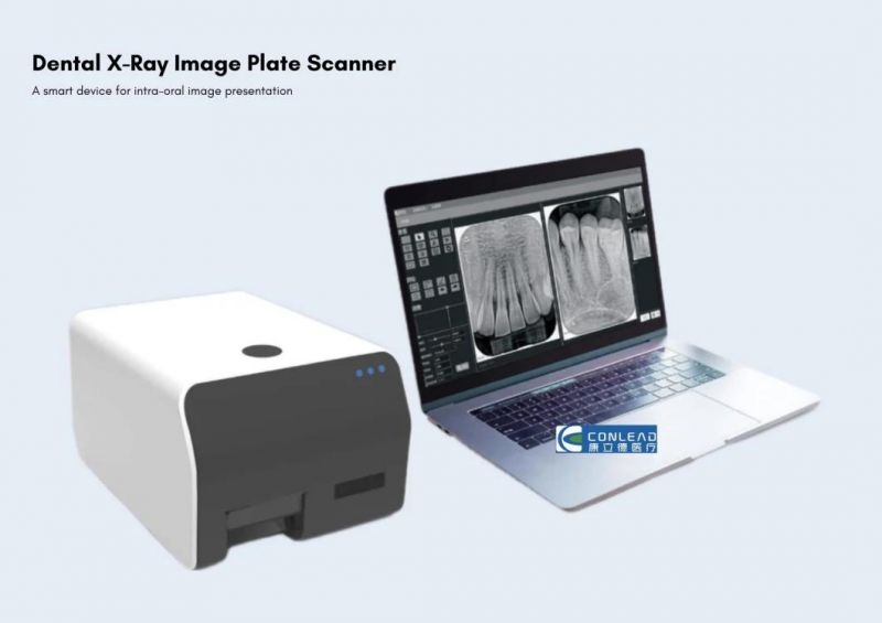 Innovative Imaging Plate Scanner for All Small Formats