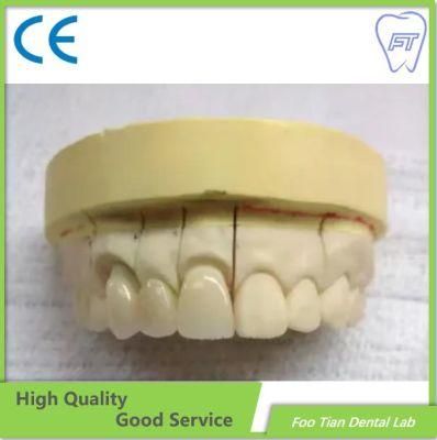 Factory Manufacture Zirconium Crown Custom Dental Material Lab Implant Dental Lab Full Contour Without Porcelain