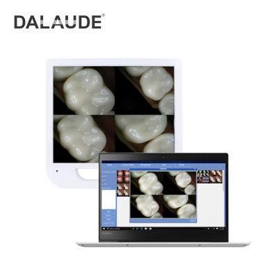 Design Intraoral Camera Mouth Viewer Capture with Multifunction Button