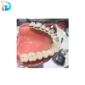 CAD Cam Open System Dental Peek Blocks for Dental Lab