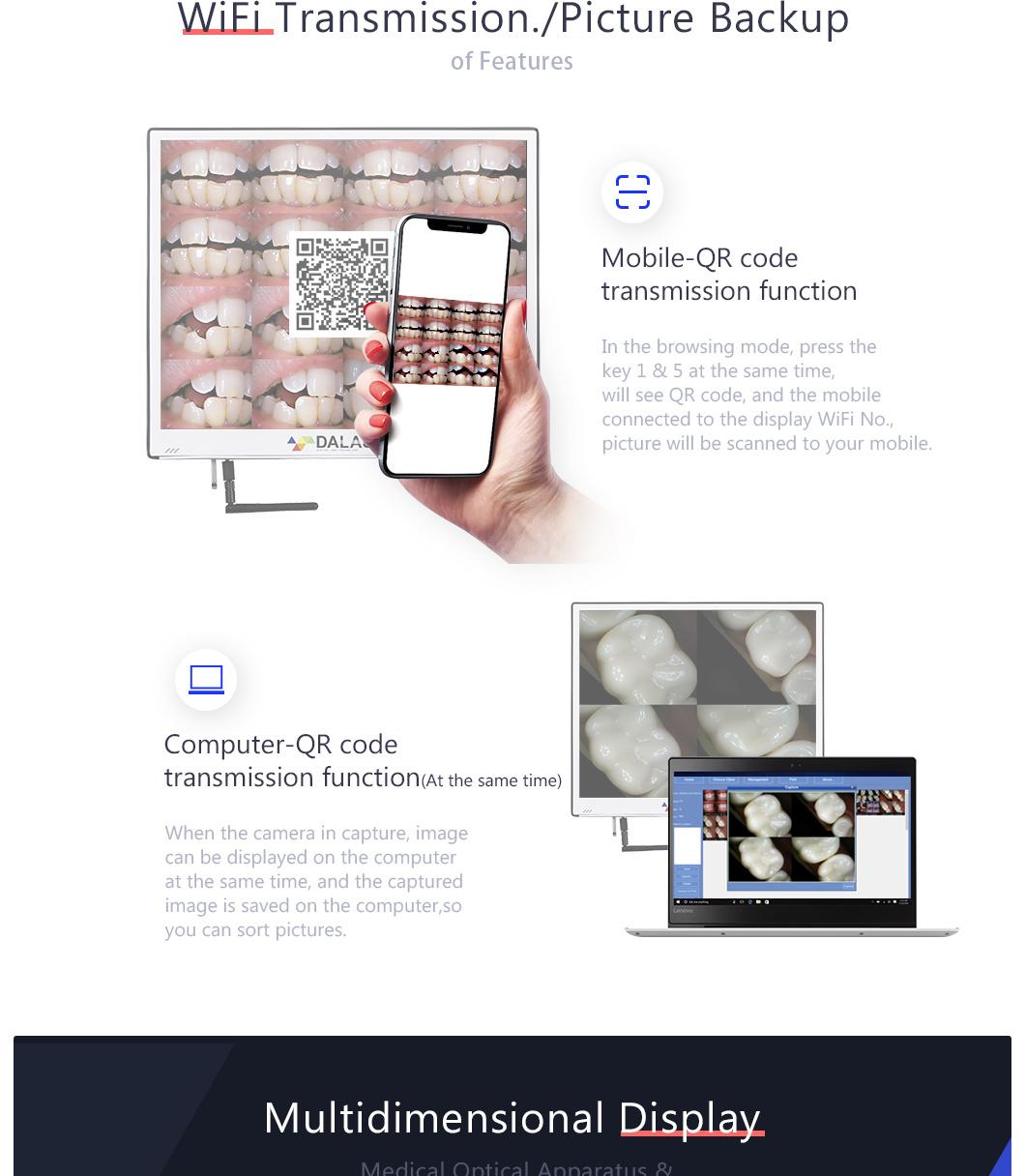 Ultra-Thin Screen High Definition Displa Intraoral Dental Camera Check-up Calculus