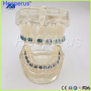 Ortho Ceramic Bracket Teeth Model Hesperus