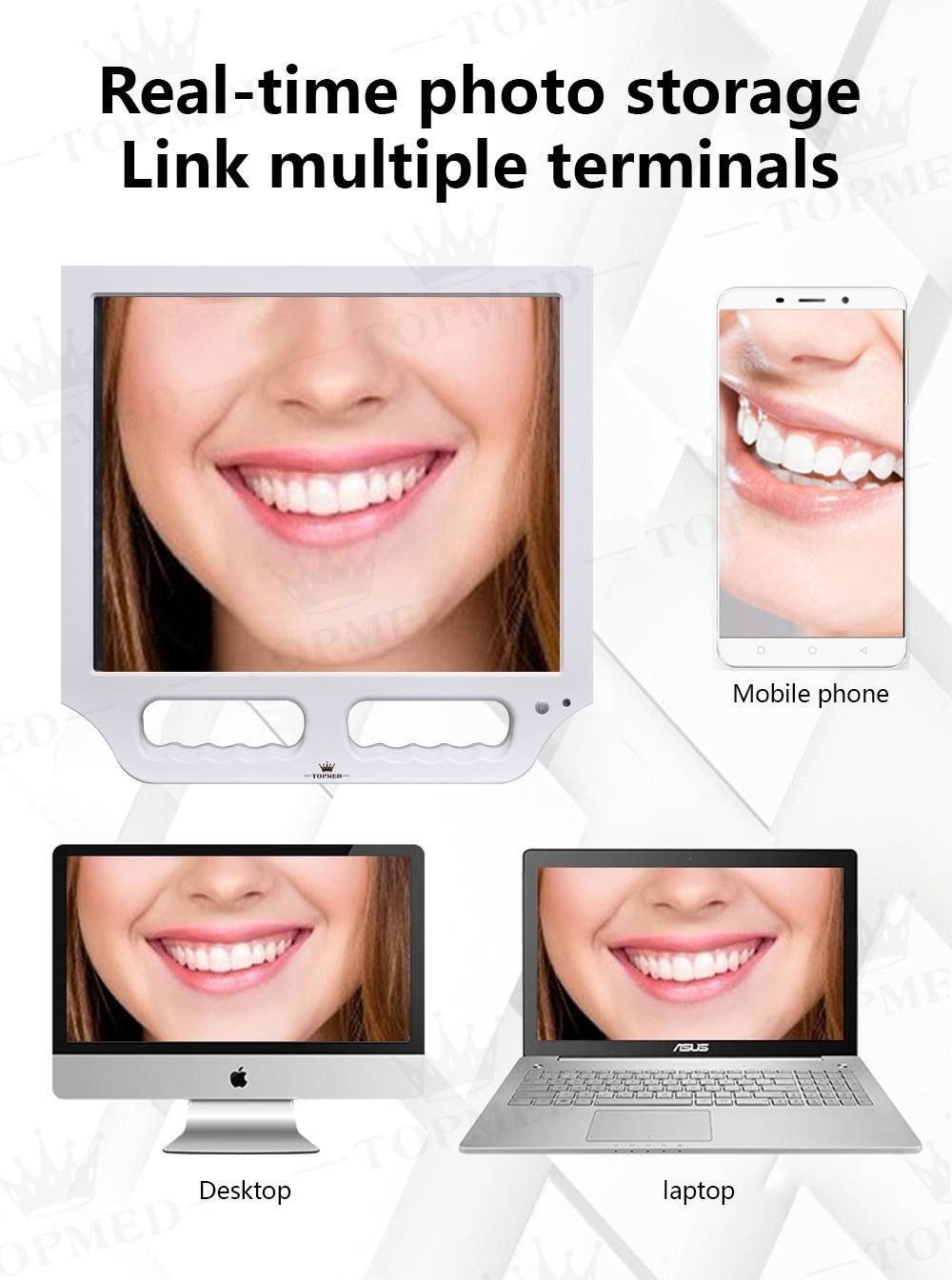 Intra Oral Scanner Dental Equipment in China Intra Oral Scanner Intraoral Camera A3m-X WiFi