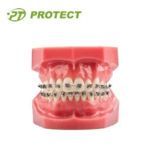 Dental Orthodontic Roth 022 Self Ligating Brackets