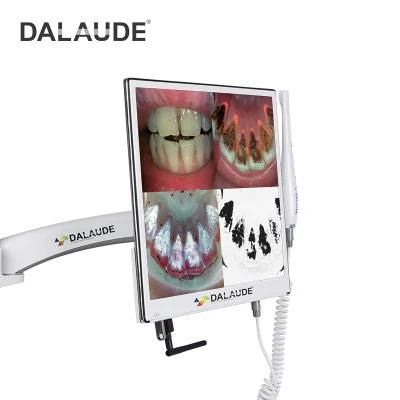 Decayed Teeth HD Screen Dental Camera Connect with Computer