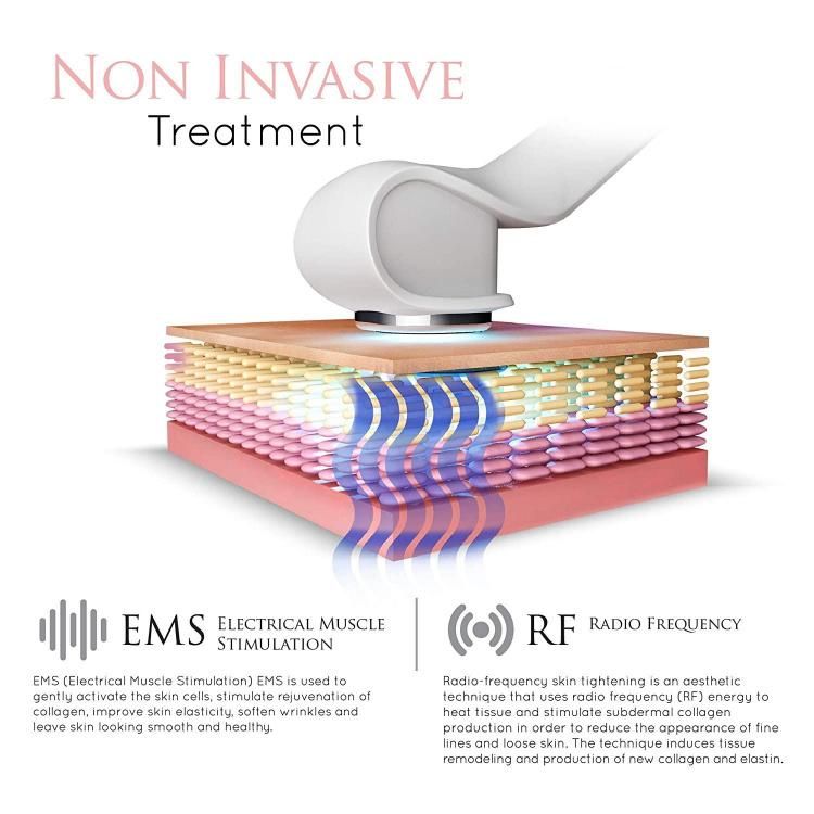 Radio Frequency Skin Tightening Vibration EMS Facial Massager for Women Home Use RF Beauty Instrument