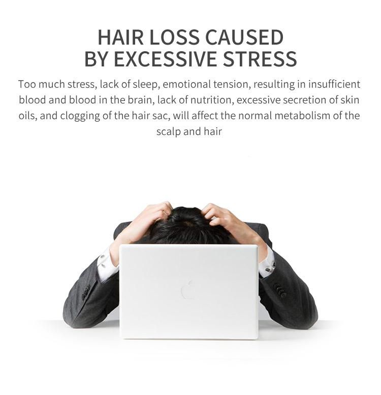 Rechargeable Portable Head Massager Scalp Stress Relax Massager